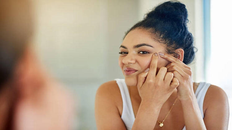 How to Fade Pitted Acne Scars?
