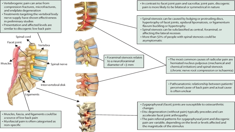 Access Lasting Acute and Chronic Pain Relief from a Pain Management Expert in New Jersey